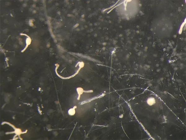 Turritopsis dohrnii cyst beginning to form a stolon