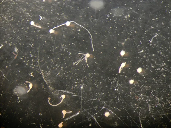 A cyst developing a stolon into a new polyp