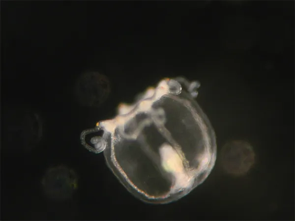 A newborn Turritopsis dohrnii medusa