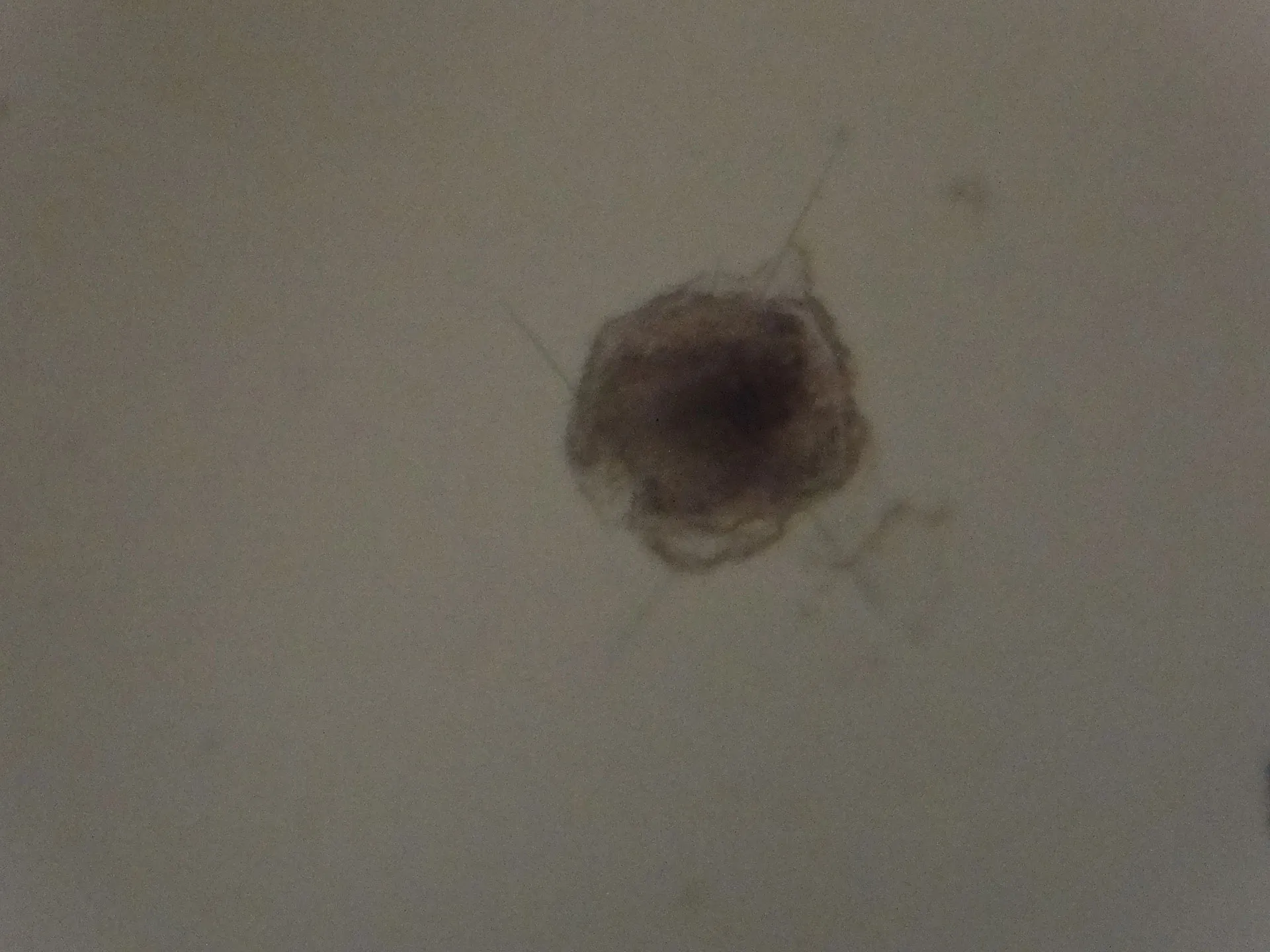 Microscope view of Turritopsis dohrnii