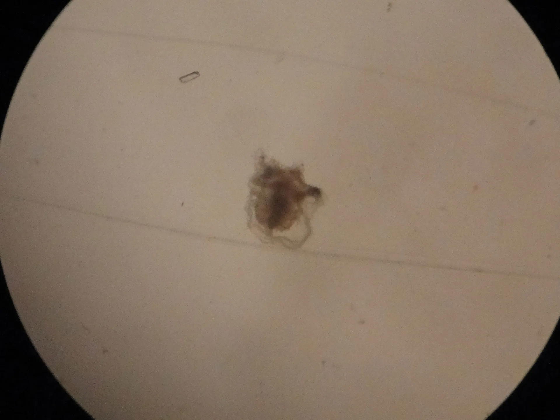 Turritopsis dohrnii specimen being examined